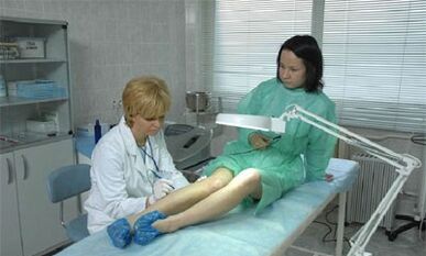 come trattare le vene varicose sulle gambe